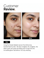 BRIVA SKIN 10%VITAMIN C FACE SERUM